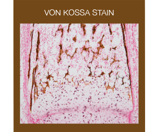 Von Kossa