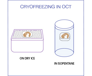 cryofreezing